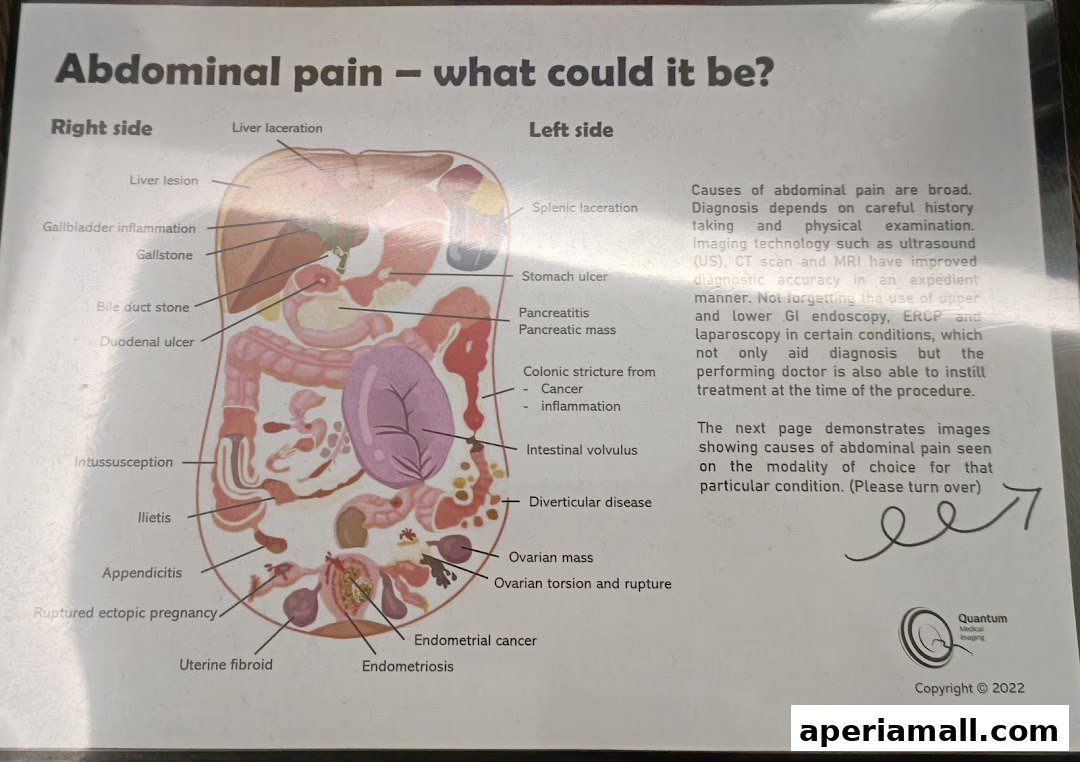 An anatomical diagram illustrating potential causes of abdominal pain.